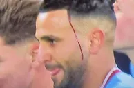 上场就是拼！曼城球迷社媒晒照，马赫雷斯在场上拼到头部流血