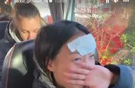 巴黎女足队友晒李梦雯额头受伤照：艰难的时光到来了