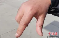 西宁“消杀员”：只盼病毒可消疫可除