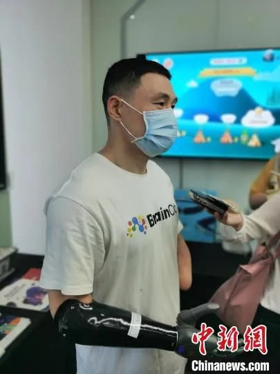 智能仿生手受益人倪敏成。　张雨滴 摄