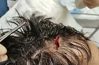 亚运队球员阿布拉汗晒头部受伤照：每一种热爱，都值得全力以赴
